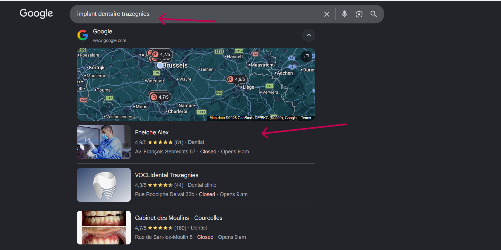 Google local map pack for implant dentaire trazegnies, Fneiche Alex ranked first