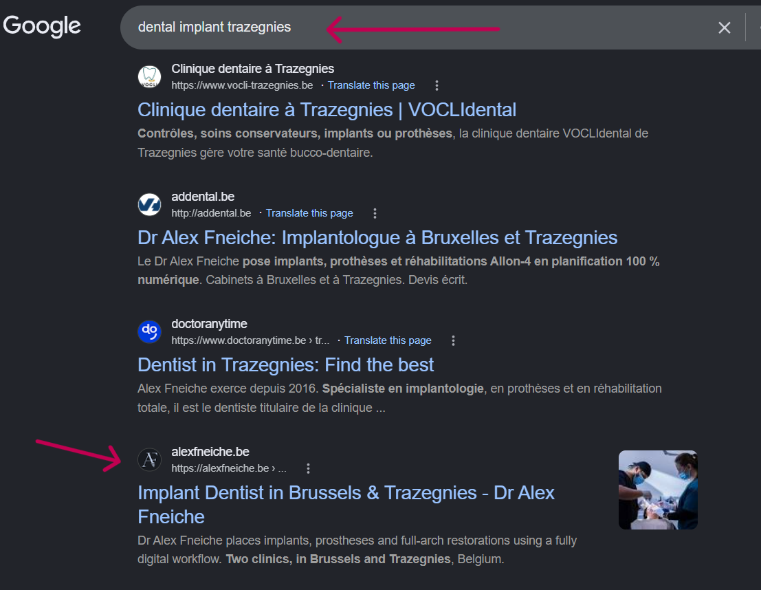 Google organic results for dental implant trazegnies showing alexfneiche.be on page one
