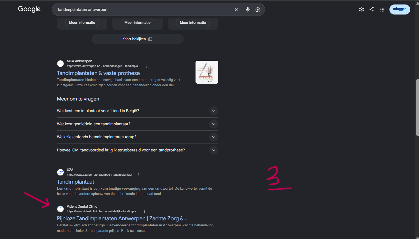 Ranking 3 for Tandimplantaten antwerpen