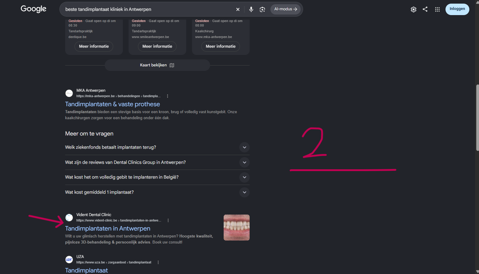 Ranking 2 for beste tandimplantaat kliniek in Antwerpen