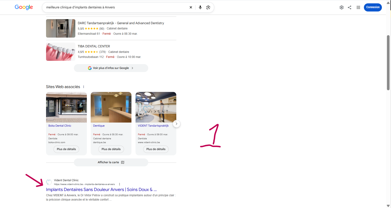 Ranking 1 for meilleure clinique d'implants dentaires à Anvers