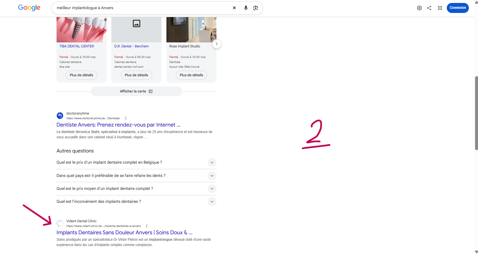 Ranking 2 for meilleur implantologue à Anvers