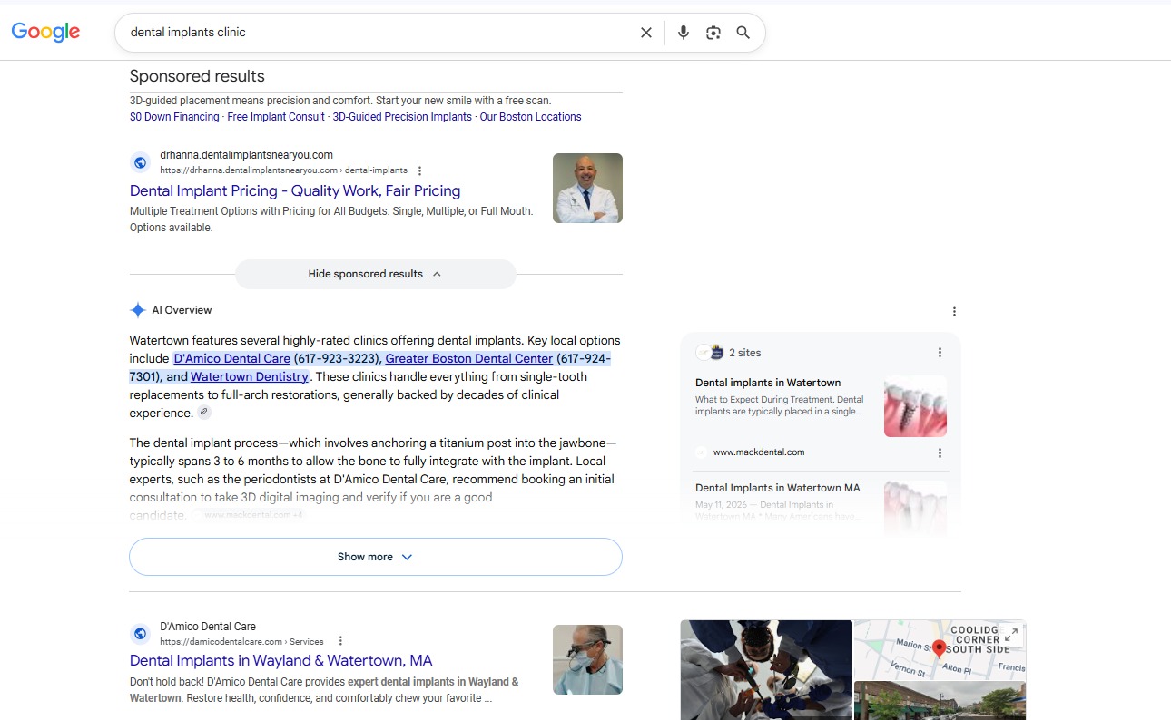 Google AI Overview Indexing - Dental Implants