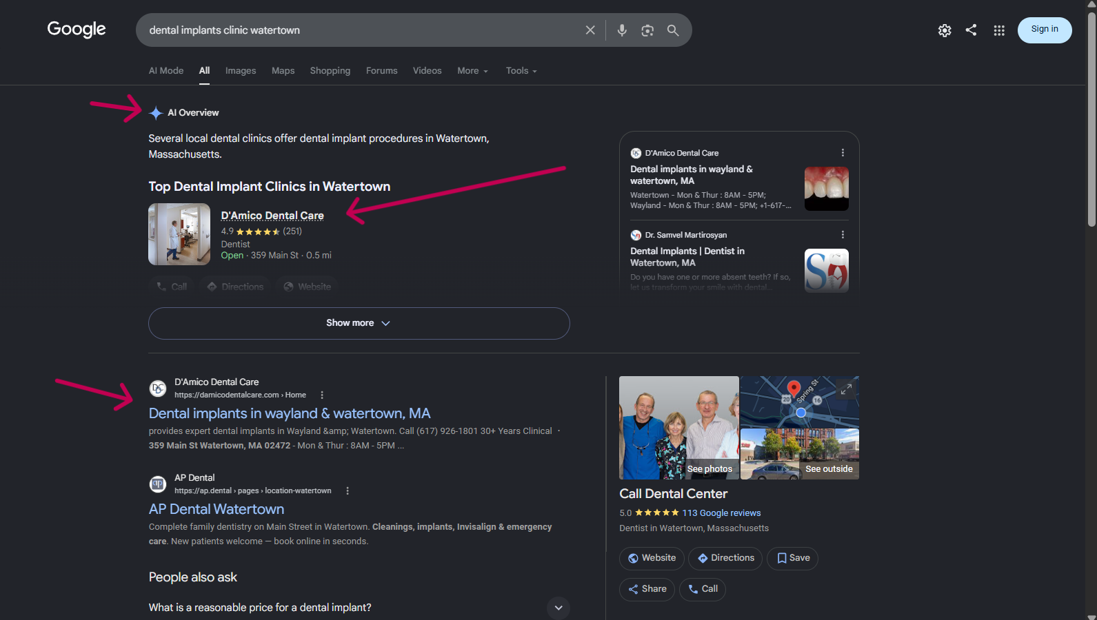 Google AI Overview and number one organic result for dental implants clinic watertown, both featuring D'Amico Dental Care